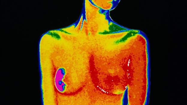 Senegal to offer free breast cancer treatment