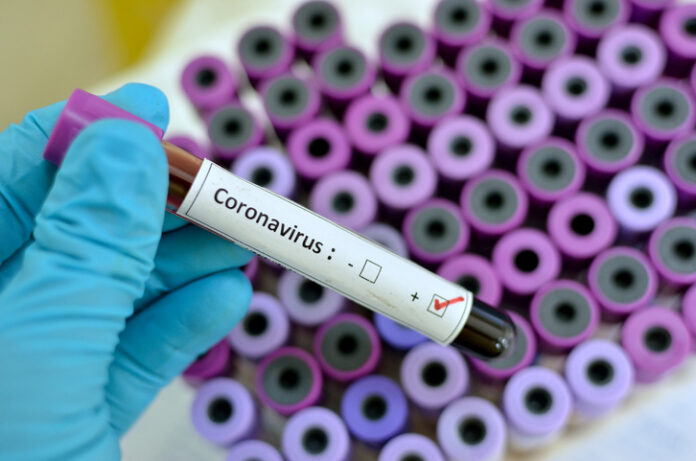 COVID-19 active cases in Ghana drop to 904