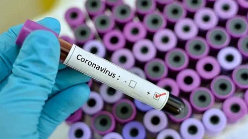 Nigeria records 796 cases, highest single-day infections since COVID-19 began 