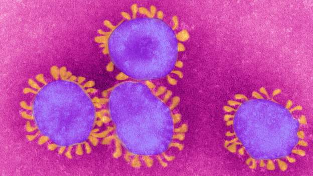 Egypt confirms second coronavirus case
