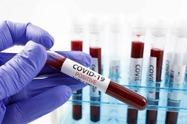 COVID-19: Ghana records over 1,000 new cases for fifth consecutive day