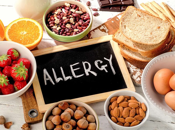 What causes allergies?