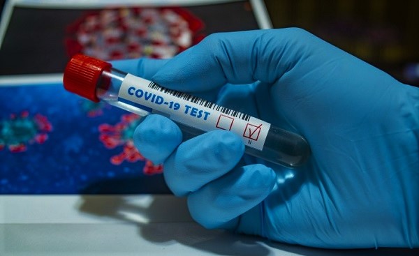 Coronavirus: Ghana's case count increase by 542