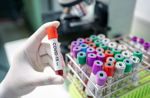 Stop mass testing for COVID-19 unless authorised – Central Regional GHS orders