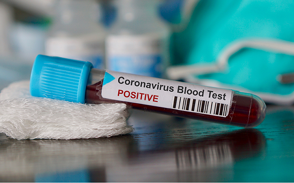 339 new cases push Ghana's COVID-19 count to 12,929