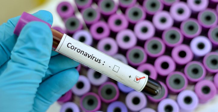 FDA advises public to stay away from self-testing kits on COVID-19