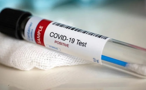 Chinese who tested positive for Coronavirus in Kumasi resisted testing - GHS