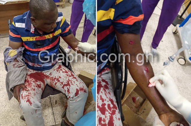 Accra: Man miraculously survives assassins close range gunfire