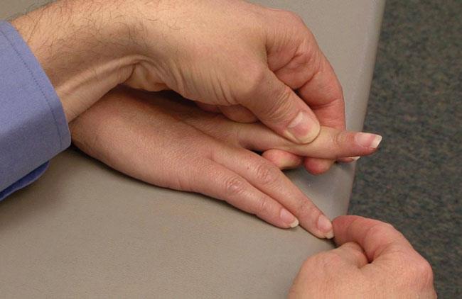 Treating a locked finger