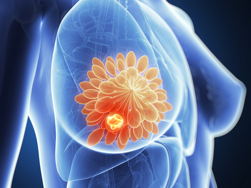 Women over 40 years must have their breasts examined regularly