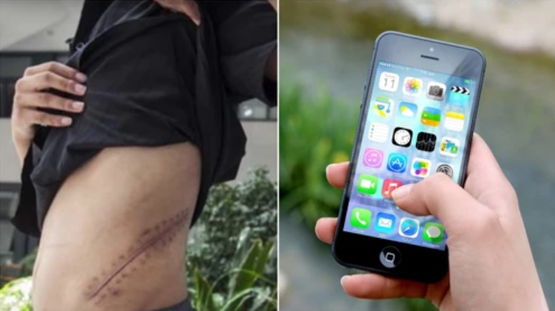 Teenager who sold his kidney for an iPhone is now bedridden
