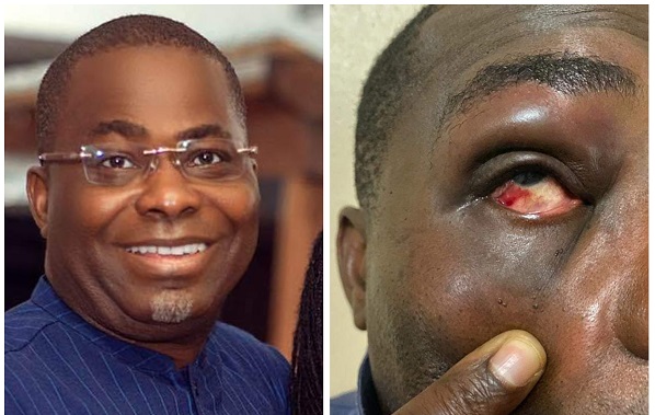 I was not the aggressor - Charles Bissue speaks on brawl with MP