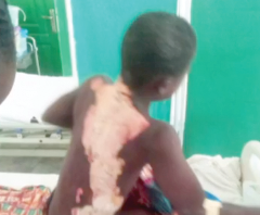 Woman demands  justice for burnt son