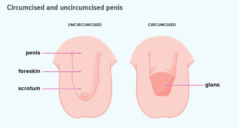 Do women prefer circumcised or uncircumcised penises? 