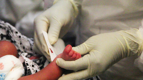 Newborns to undergo free Sickle cell screening at 37, Ridge