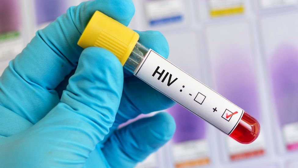 HIV findings in DR Congo 'give hope for cure'