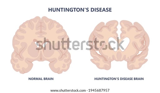 Picture credit: Shutterstock