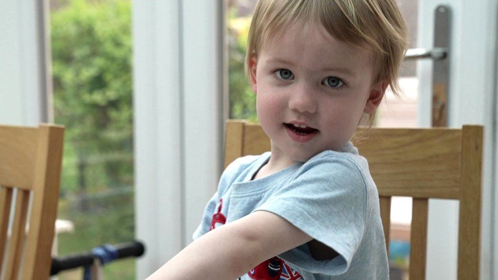 Likely cause of mystery child hepatitis outbreak found