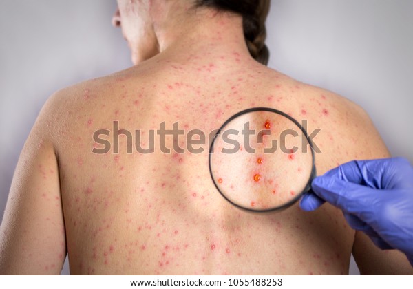 Picture credit: Shutterstock