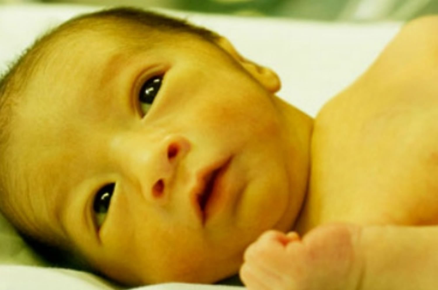  The myths around the newborns continue to put countless number of babies at risk of neonatal jaundice