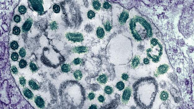 Marburg Virus Disease: Ghana confirms first two cases