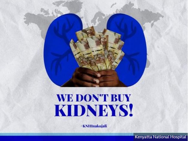 No, we don't buy kidneys - Hospital