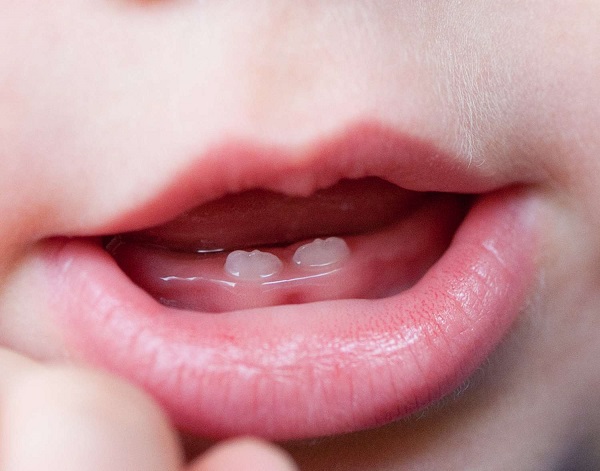 What do you know about newborns with teeth?