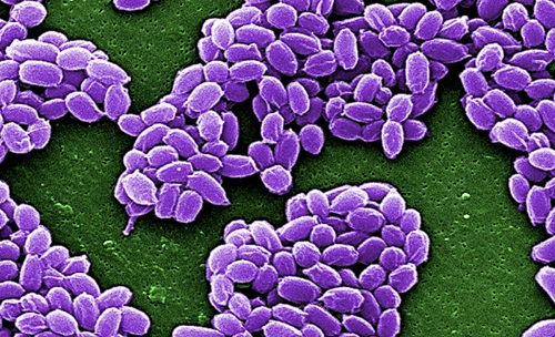 Upper East Region: Anthrax outbreak claims one life
