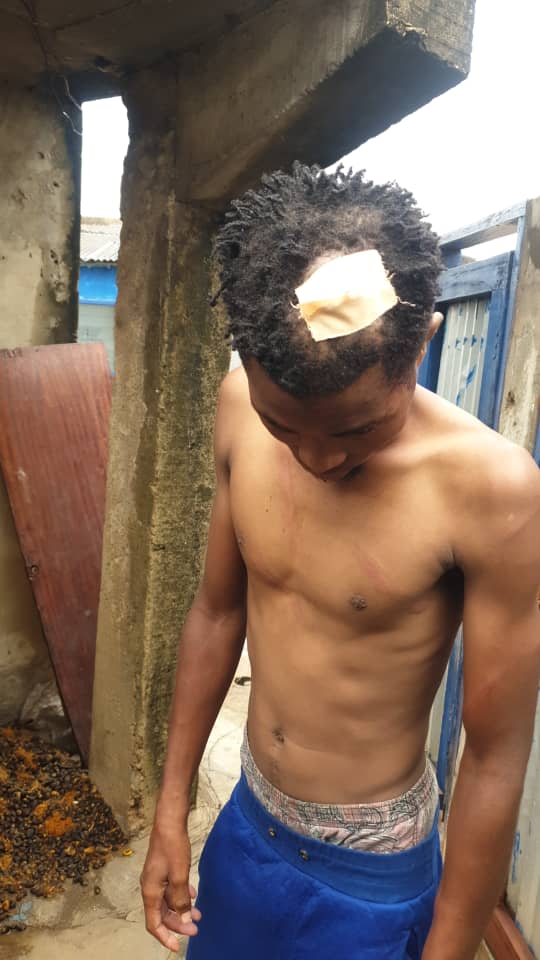 One of the victims of the Ashaiman military operation, which was sanctioned by GAF high command