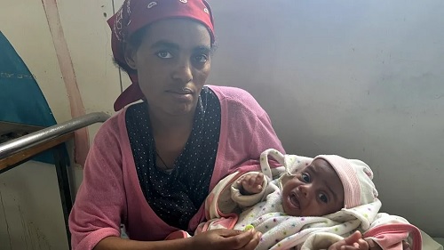 Tsega Tsigabu's baby is one of the many suffering from malnutrition in Ethiopia's Tigray region