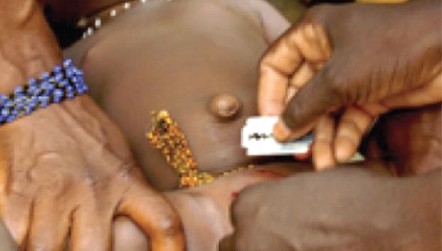 A girl-child being cut with a blade
