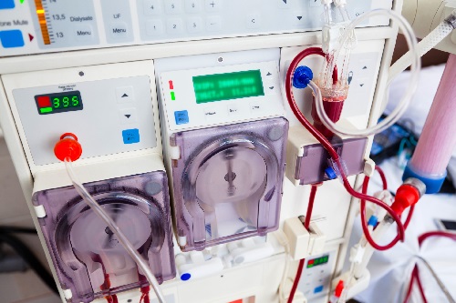 Pharmaceutical firm to begin local production of dialysis device  (FILE PHOTO)