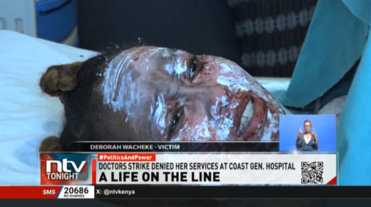 Kenyan woman battles for her life after boyfriend scalds her with hot oil