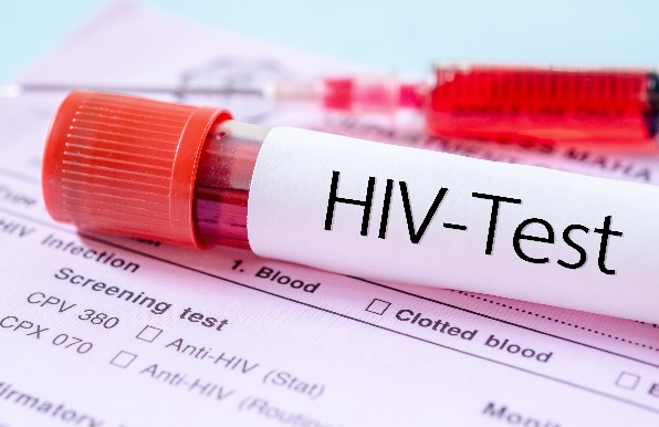 HIV Self Testing confirms 239 positive cases 