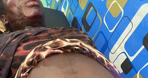 Oti Region: Husband inflicts cutlass wounds on pregnant wife