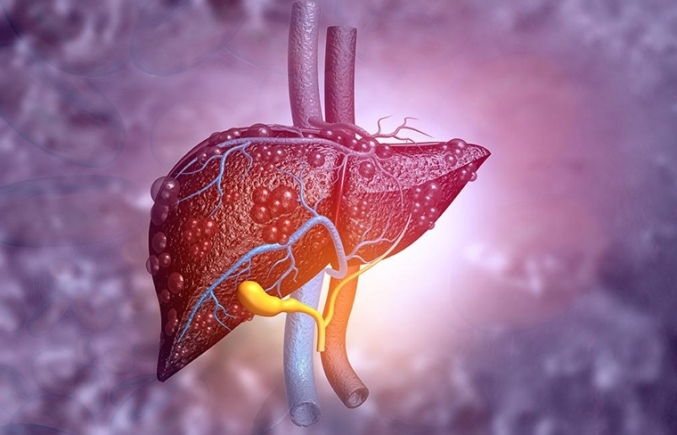 Hepatitis claimed 15,000 lives in 2022 