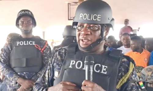 IGP on policeman who refused leg amputation after accident
