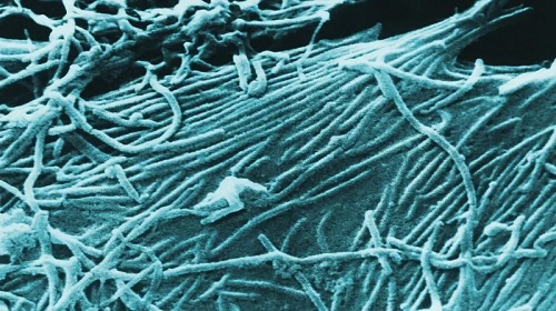 Uganda's last Ebola outbreak was in 2022