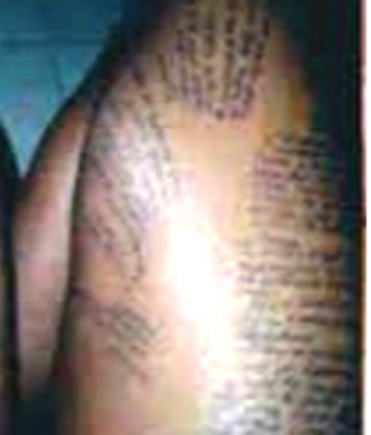 A typical  example of exams malpractice