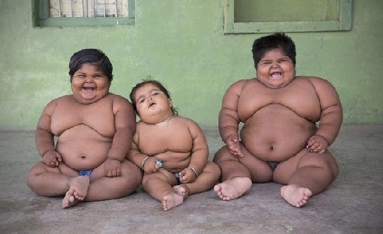 One in 10 children worldwide obese 