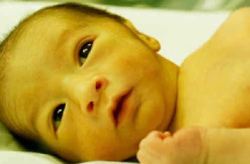 Neonatal jaundice  – a dangerous but preventable affliction of newborns