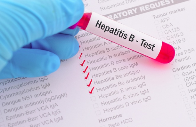 New Hepatitis B drug approved by US FDA offers patients a chance to ditch lifelong medication