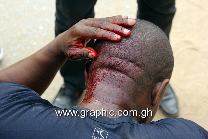Blood oozes from the head of a victim of Thursday violence at Ayawaso West Wuogon
