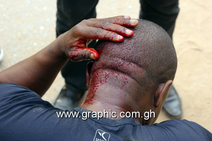 Blood oozes from the head of a victim of Thursday violence at Ayawaso West Wuogon Blood oozes from the head of a victim of Thursday violence at Ayawaso West Wuogon