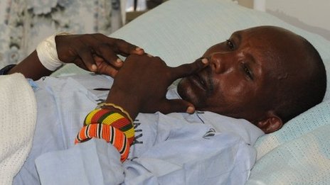 Nine police officers reman in hospital after the attack.