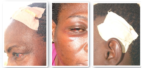 Some of the victims of the robbery attack