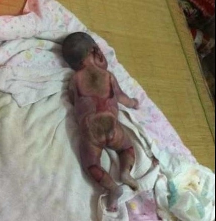 The charred body of the 12-day old baby