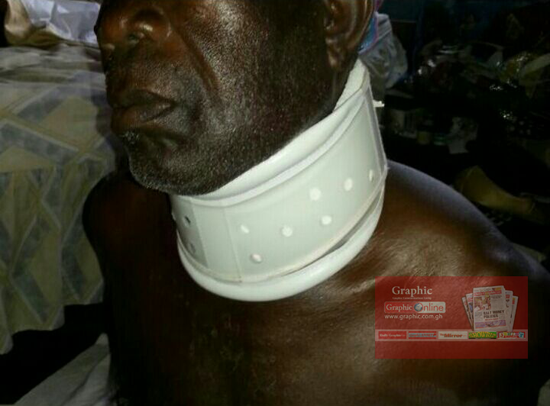 The neck of the70-year-old man which was slashed