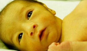 Any baby with untreated severe jaundice is at risk of brain damage from the jaundice