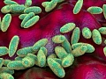 Pneumonic plague is often described as the most virulent form of plague
